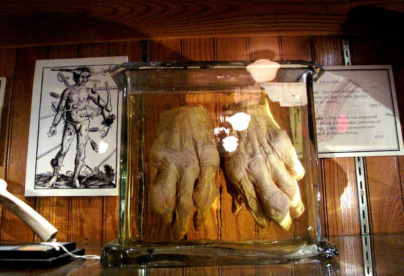 Illustration for article titled Museum of WTF: Mutant Pickled Babies and the World's Largest Colon